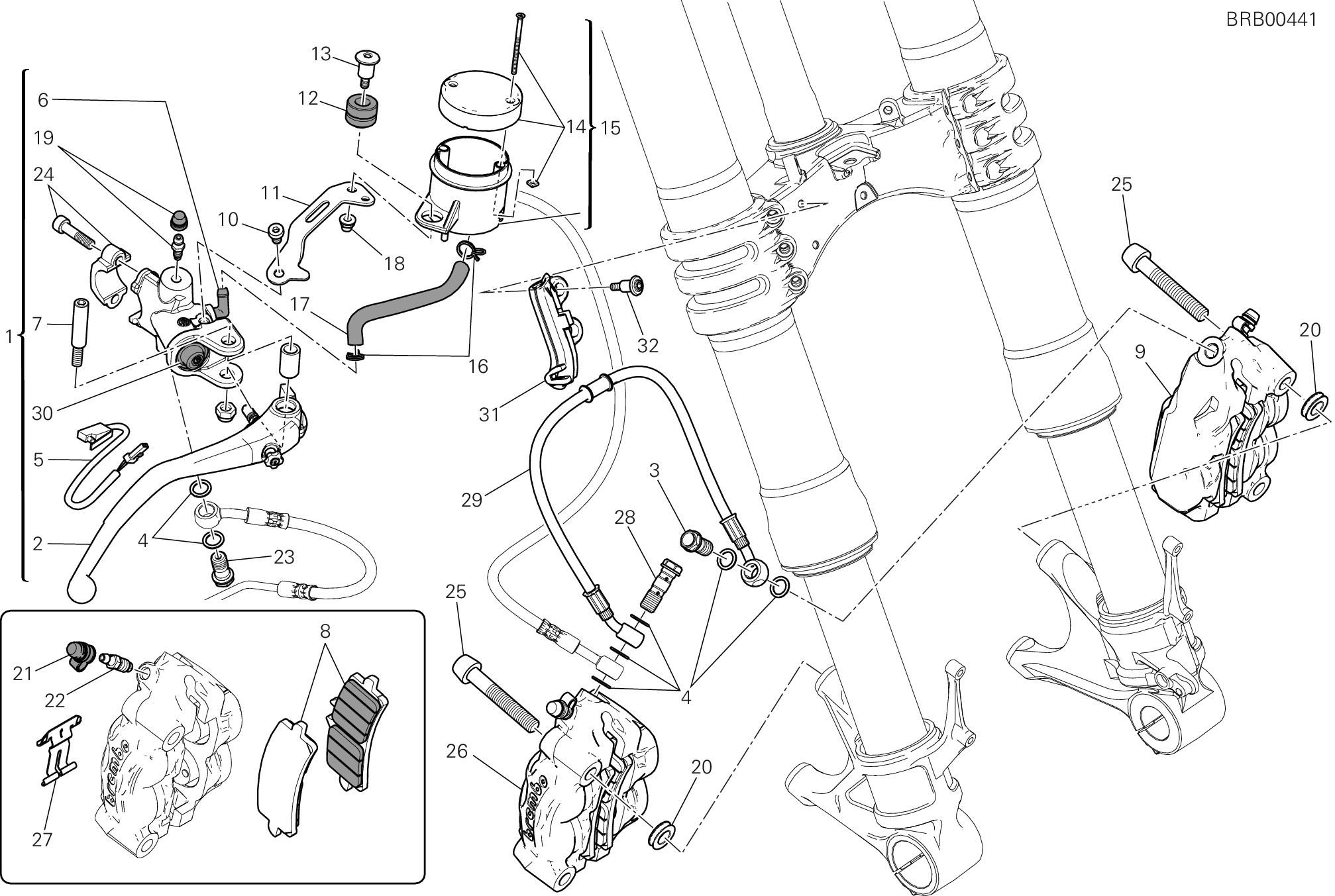 Systeme de frein avant